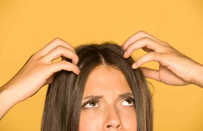 Woman scratching dry scalp