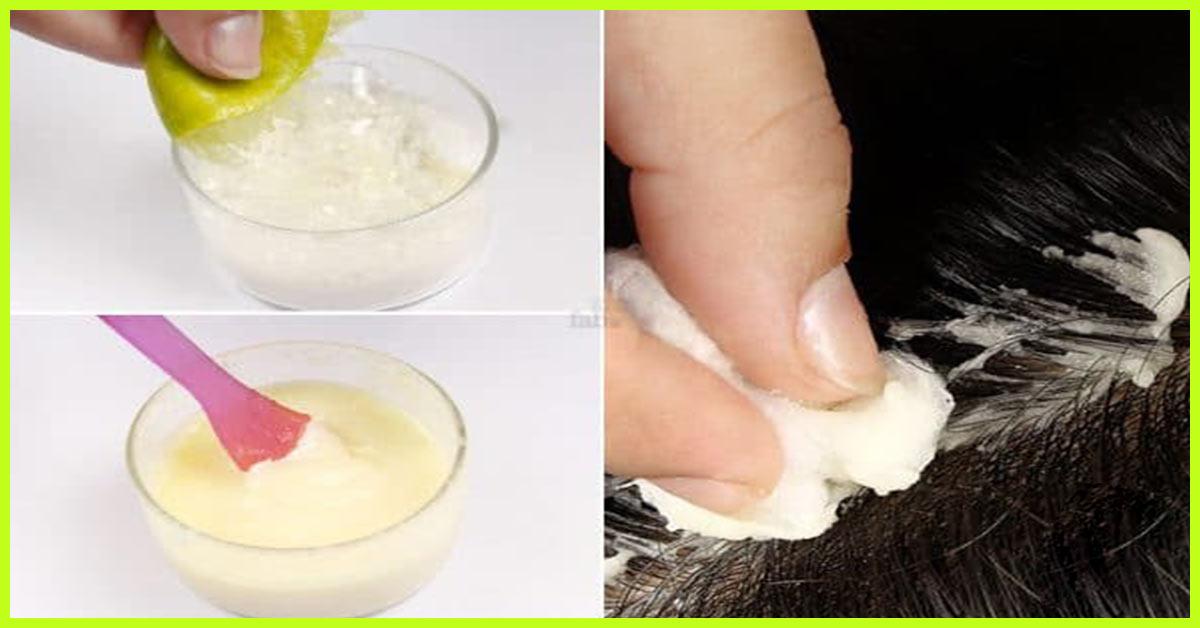 treatment skin uses Using Of Dandruff Baking How To Get Soda? Rid