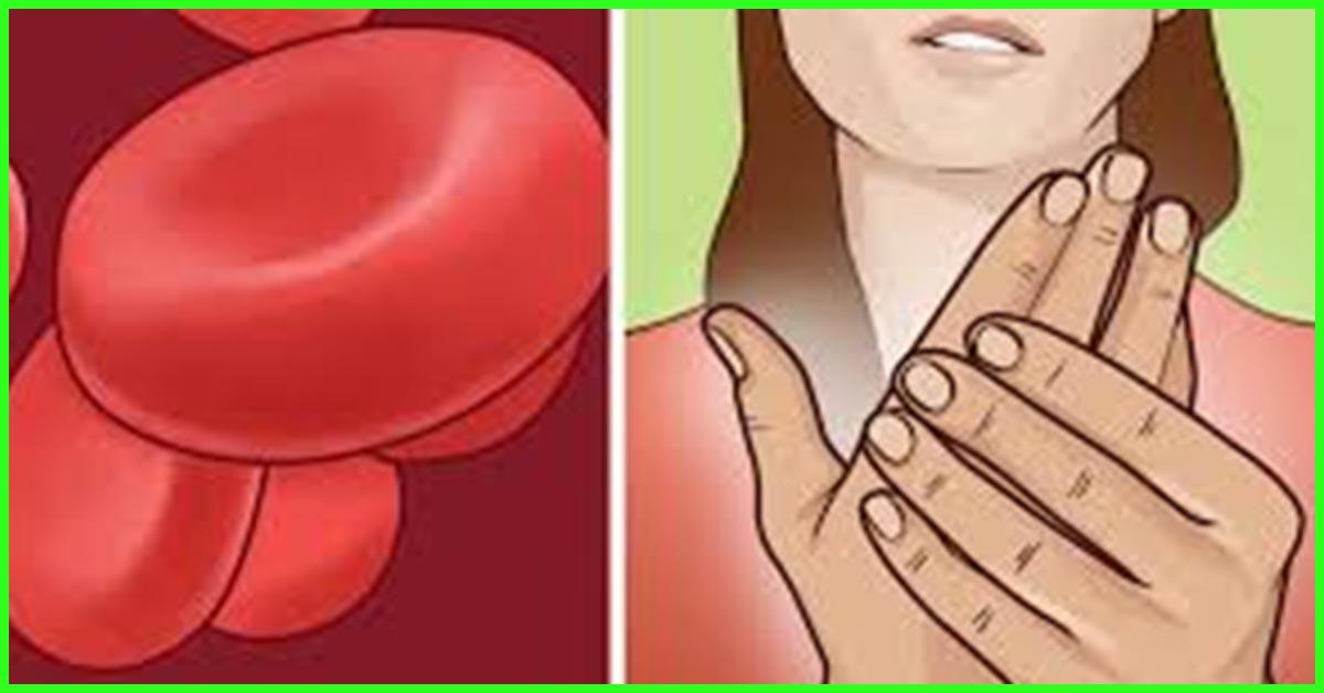 Iron Deficiency Causes, Symptoms And Treatment