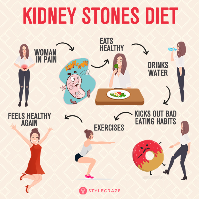  Kidney Stones Diet Foods List Benefits And Lifestyle Changes