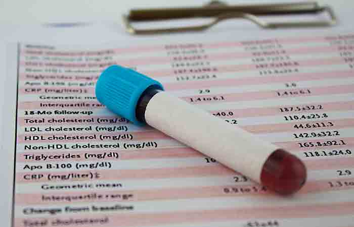 Blood cholesterol test results