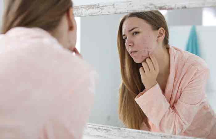 Woman-checking-her-acne-in-the-mirror