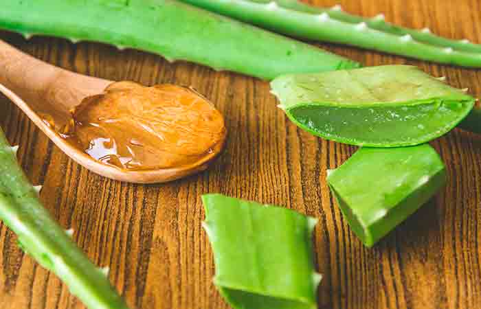 Aloe vera gel for keloids removal