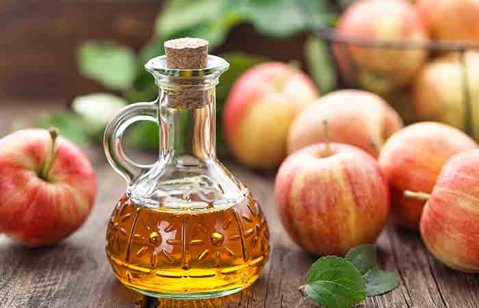 Apple cider vinegar for keloids removal
