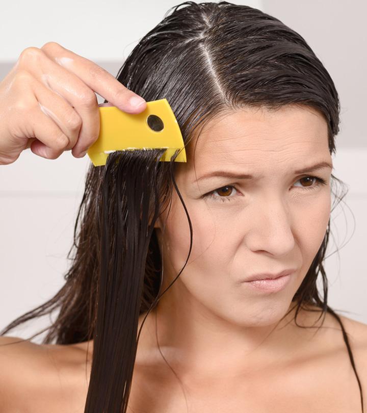 How To Get Rid Of Head Lice And Eggs + Prevention Tips