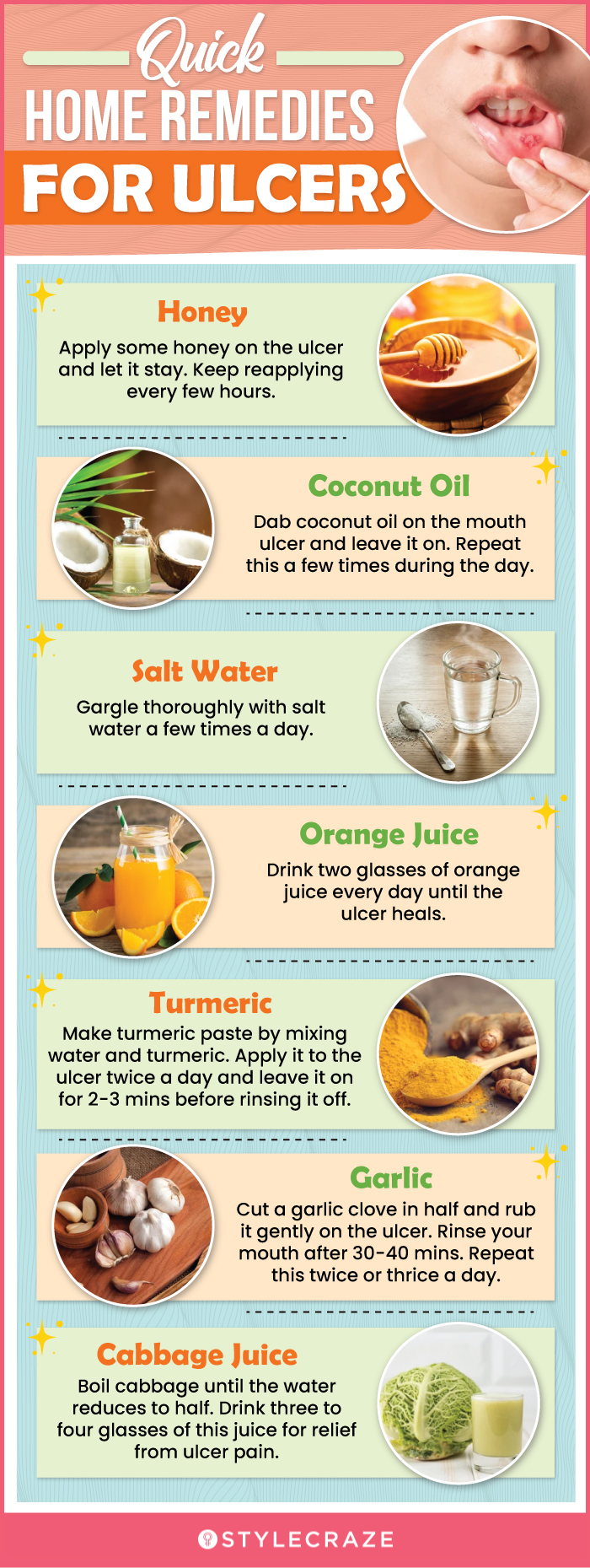 quick home remedies for ulcers (infographic)
