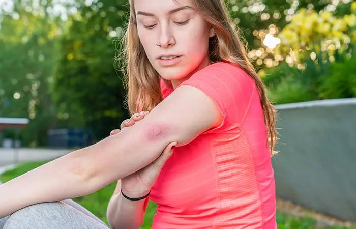 Slippery elm is beneficial for wounds, cuts, and bites