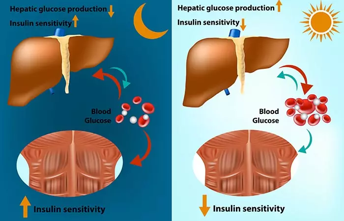 What Is Insulin Resistance