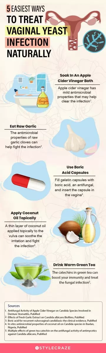 5 easiest ways to treat vaginal yeast infection naturally (infographic)