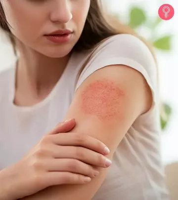 Manage that contagious fungal skin infection with easy yet effective home remedies.