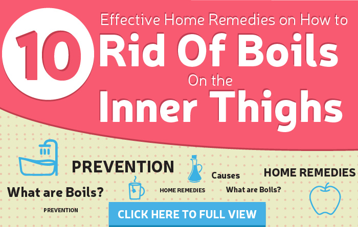 Natural ways to get rid of boils on the inner thighs