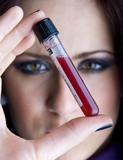 Blood sample collection for testing to diagnose anemia