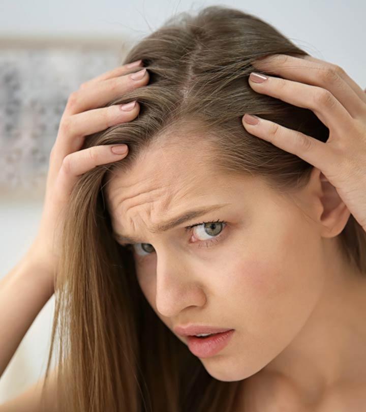 Receding hairline Treatment stages and causes