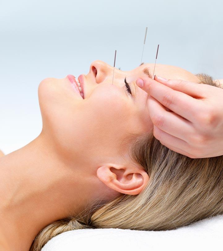 Acupuncture For Healthly Sleep And To Cure Insomnia