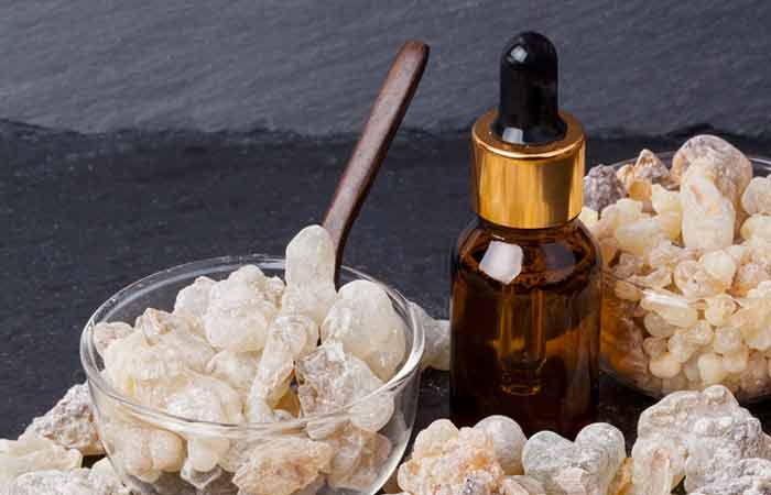 Frankincense oil as home remedy for vertigo