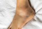 16 Home Remedies For Swollen Feet, Symptoms, And Treatments