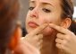 Comedonal Acne: Causes, How To Treat ...