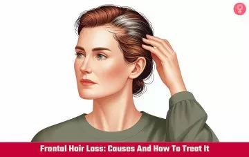 Frontal Hair Loss: Causes And How To Treat It