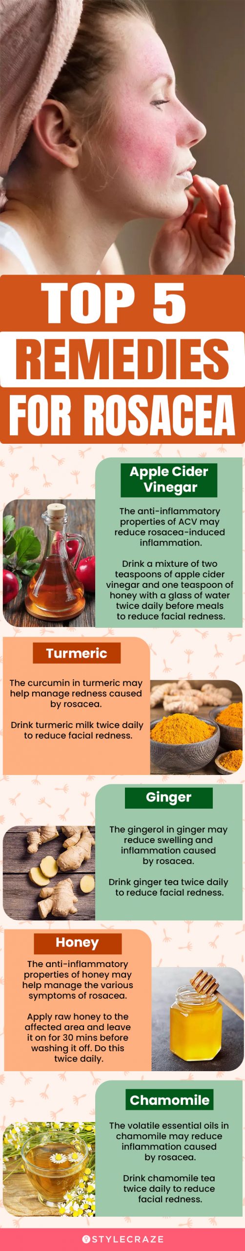 top 5 remedies for rosacea (infographic)