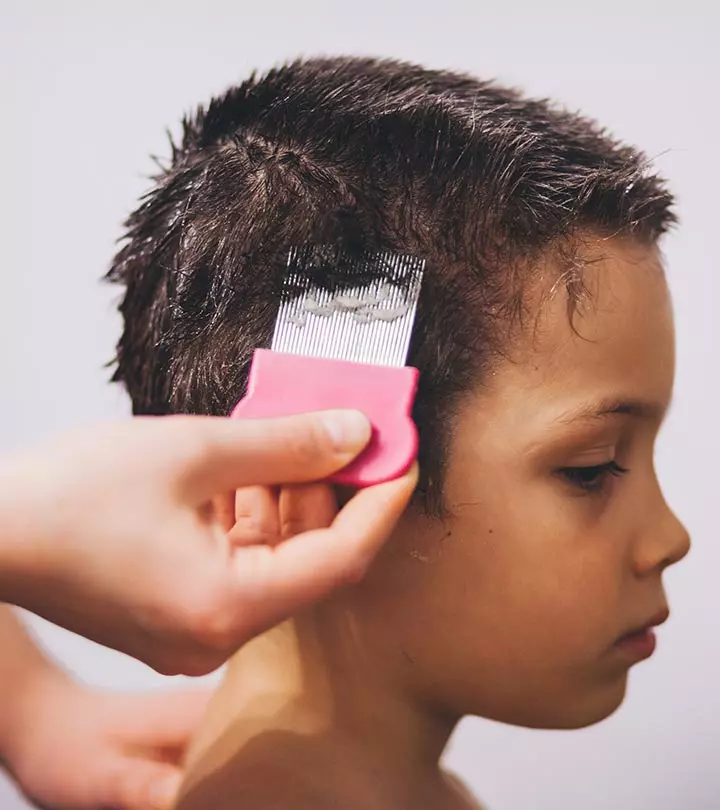 A Teen Suffering From Hair Loss