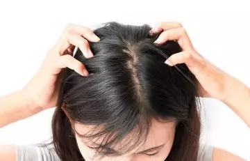 Woman suffering with itching due to head lice