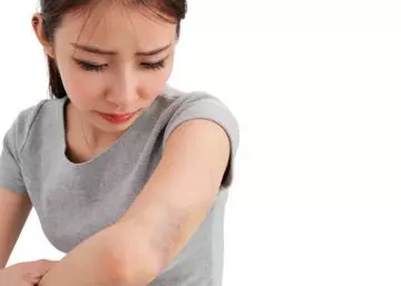 Types Of Bruises