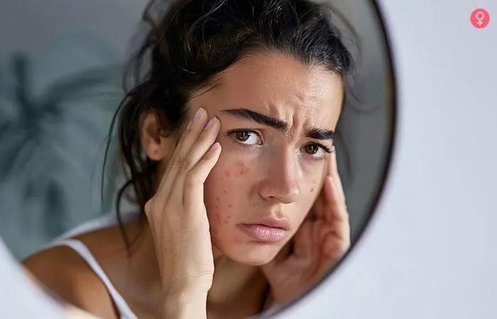 Woman examining her skin closely to see signs of breakouts