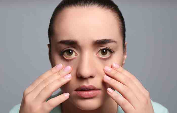Woman checking her eyes to look for signs of jaundice