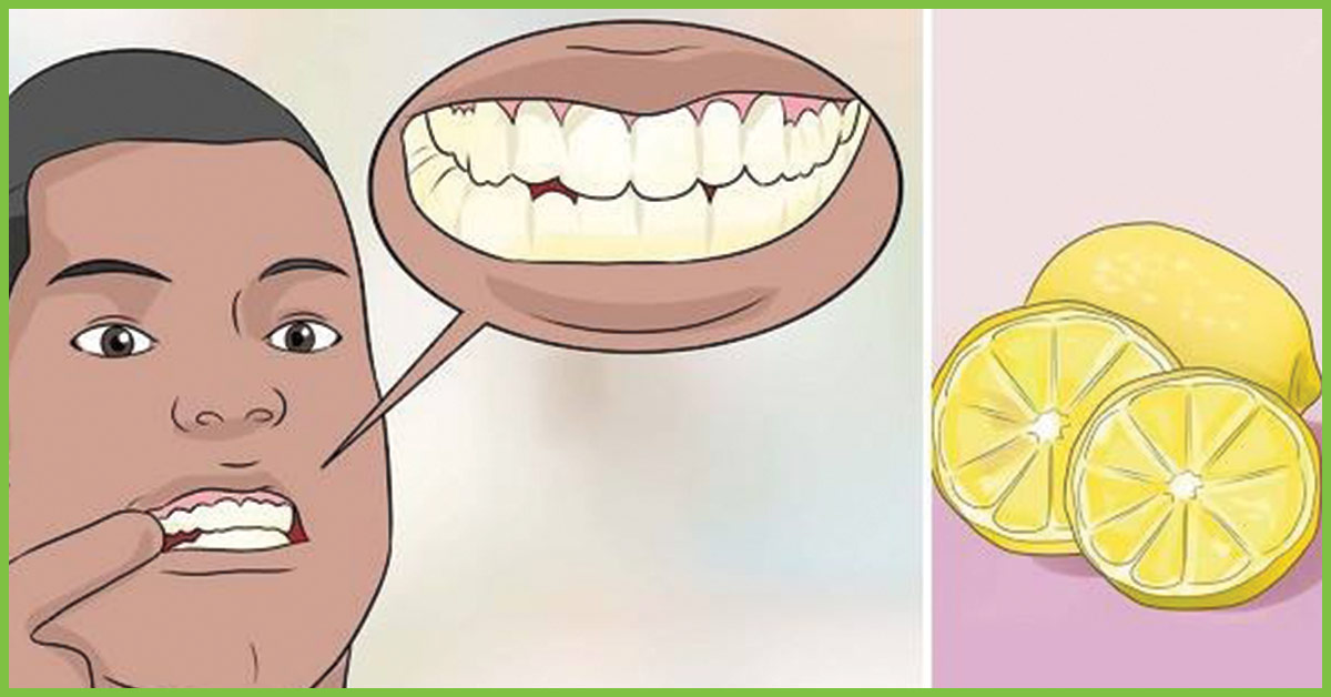 Lemon Water Teeth Damage Herbs And Food Recipes