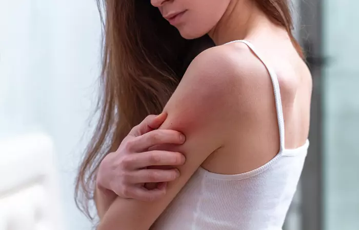 Close up of a young woman itching her skin.