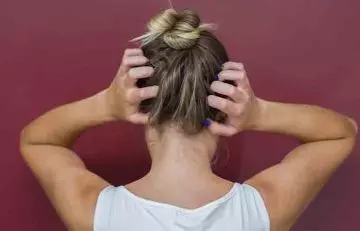 A woman scratching her head due to scalp allergy