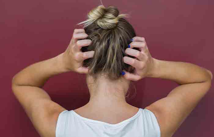 Женщина чешет голову из-за аллергии на кожу головы