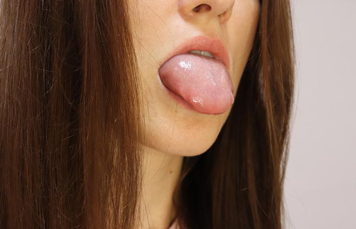 Close up of a woman's swelling tongue due to the side effects of kiwi fruit.