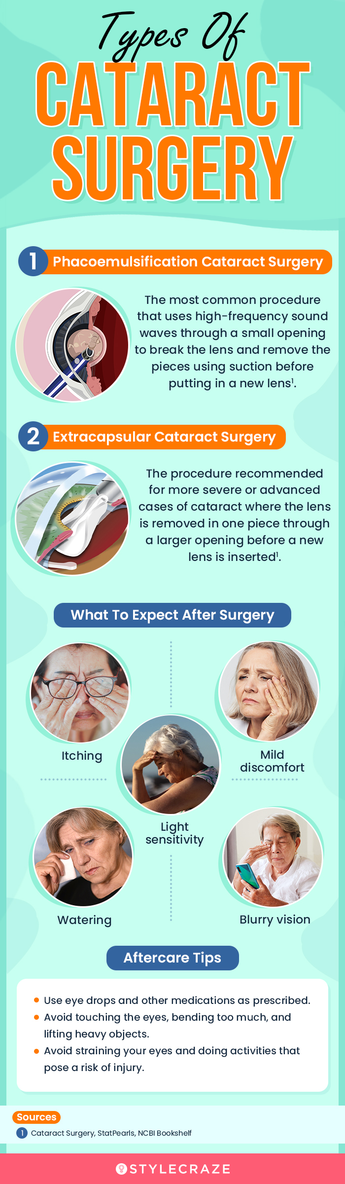 types of cataract surgery (infographic)