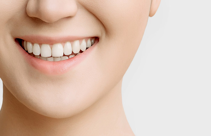 Woman smiling with healthy teeth