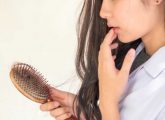 4 Remedies For Seborrheic Dermatitis Hair Loss & Treatment