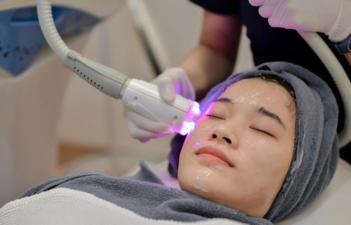 Woman getting laser treatment for acne scars