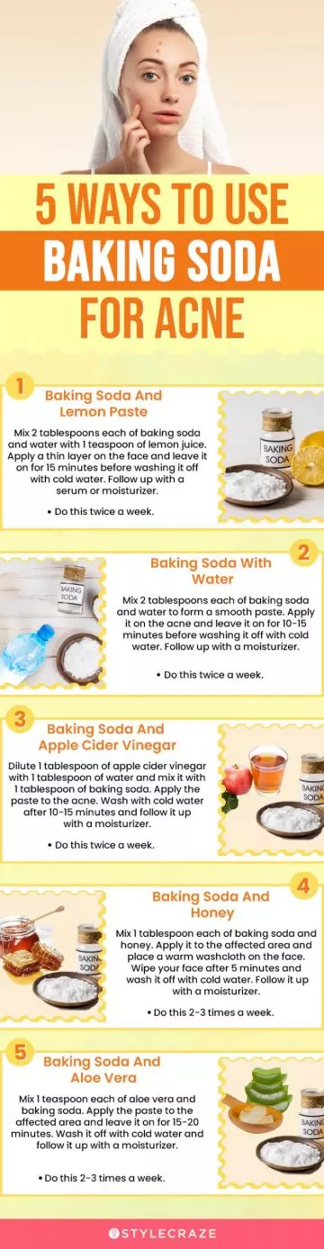 5 ways to use baking soda for acne (infographic)