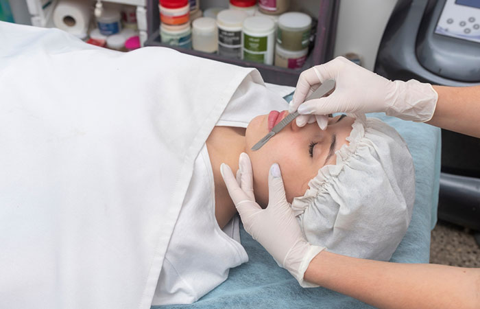 Một chuyên gia thẩm mỹ đang thực hiện Dermaplaning để loại bỏ lông trên mặt