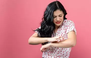 Woman scratching her itchy arm due to side effects of tamarind.