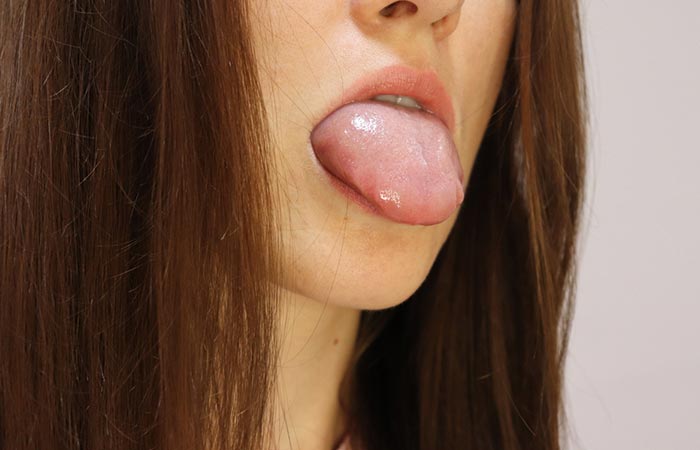 Woman with oral allergy on tongue for pineapple