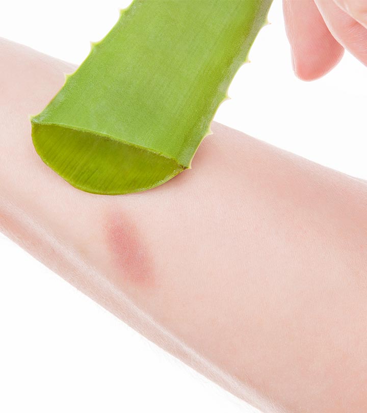 Top 10 Aloe Vera Gels For Treating Burns of 2021