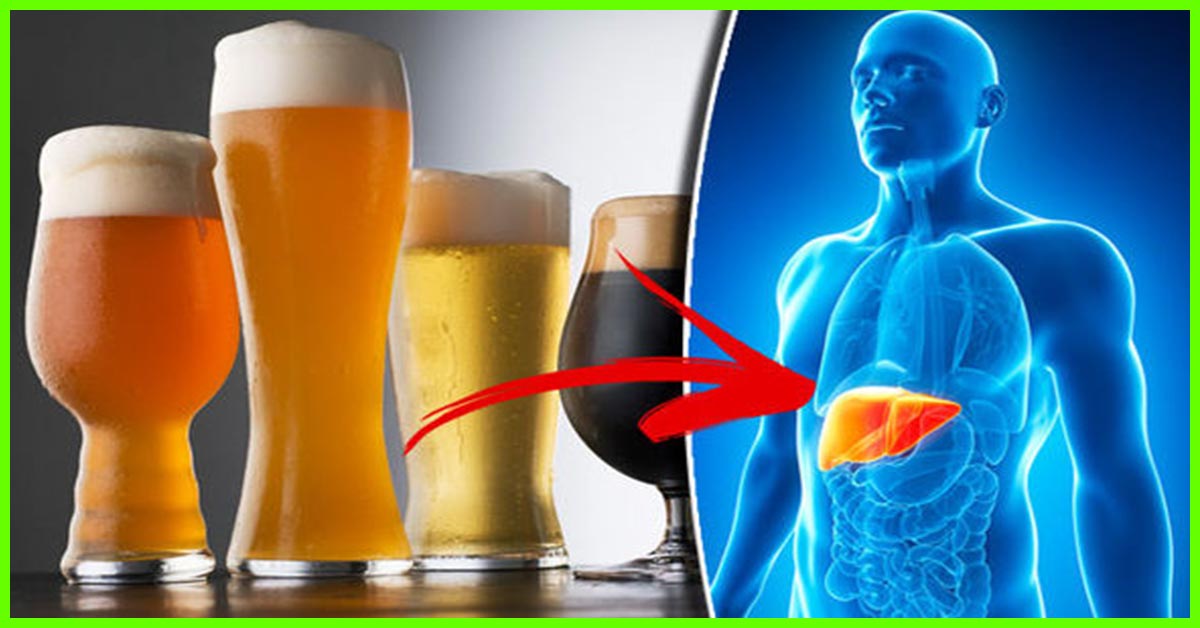 10 Top Side Effects Of Beer On Your Body And Health