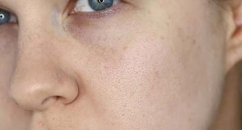 Prep your skin to make pores smaller
