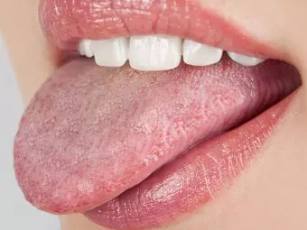 15 Effective Home Remedies For Oral Thrush