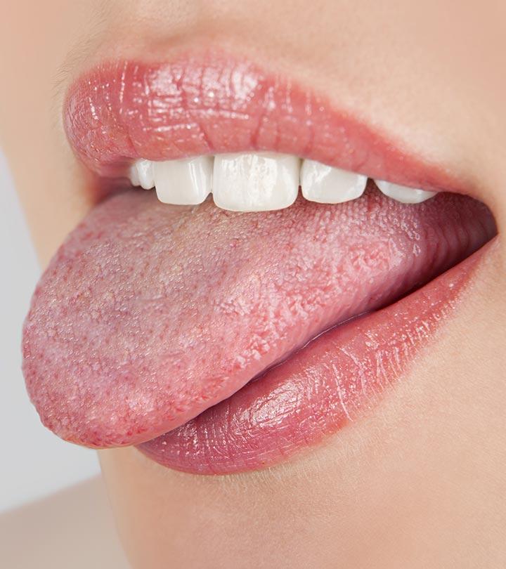 thrush on tongue treatment