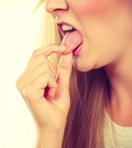 16 Home Remedies To Get Rid Of Blisters On The Tongue