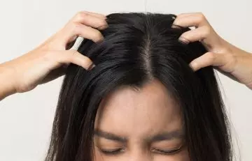 Close up of a woman itching her scalp due to side effects camphor.