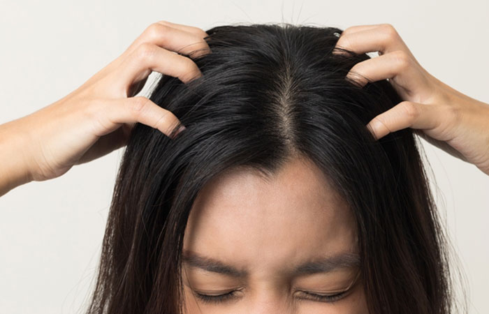 Close up of a woman itching her scalp due to side effects camphor.