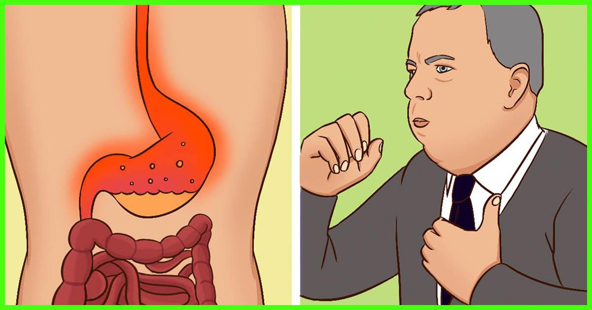 14 Home Remedies For Stomach Burning Causes And Prevention